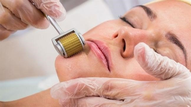 Lăn kim trị sẹo rỗ có hiệu quả không? Có nên lăn kim tại nhà?