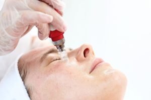 Tái tạo làn da của bạn một cách tự nhiên