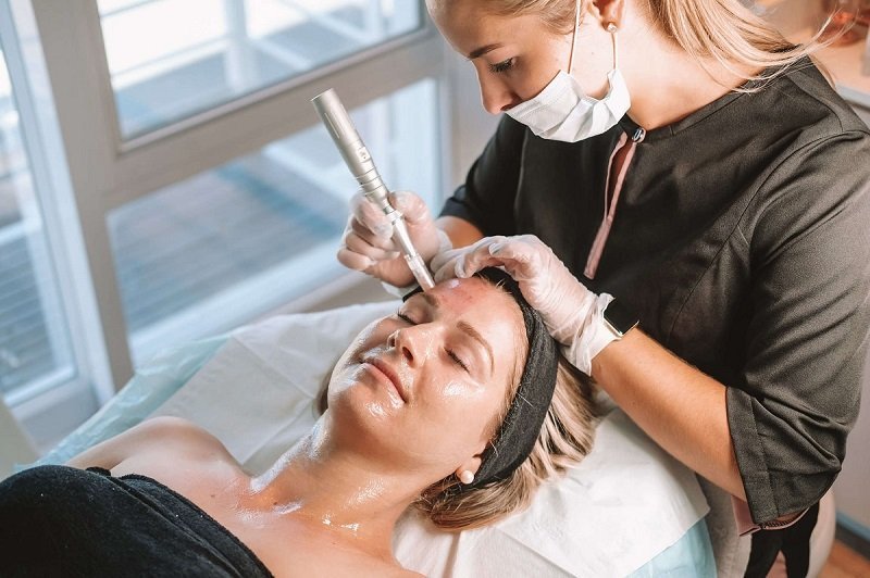 Phương pháp phi kim tế bào gốc trị mụn được không?