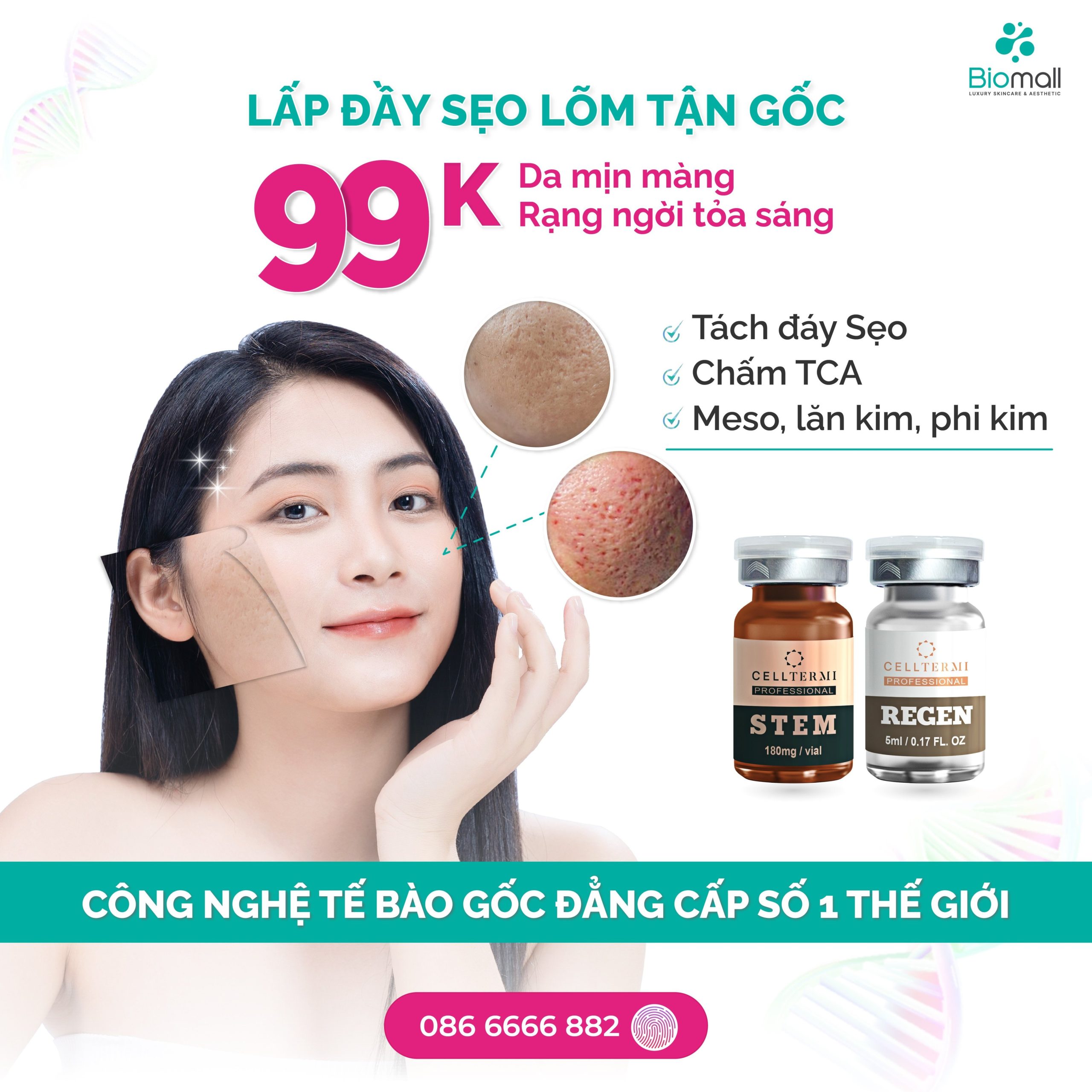 Trị sẹo lõm/sẹo rỗ giá bao nhiêu tiền năm 2023? Biomall giá chỉ từ 99K